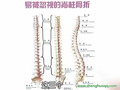 最易骨折的部位