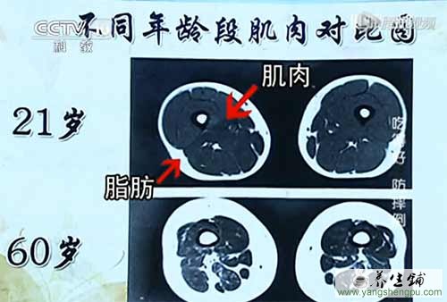 不同年龄段肌肉对比图