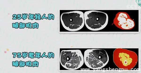 老年人与年轻人肌肉对比