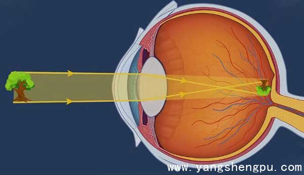 近视的原理