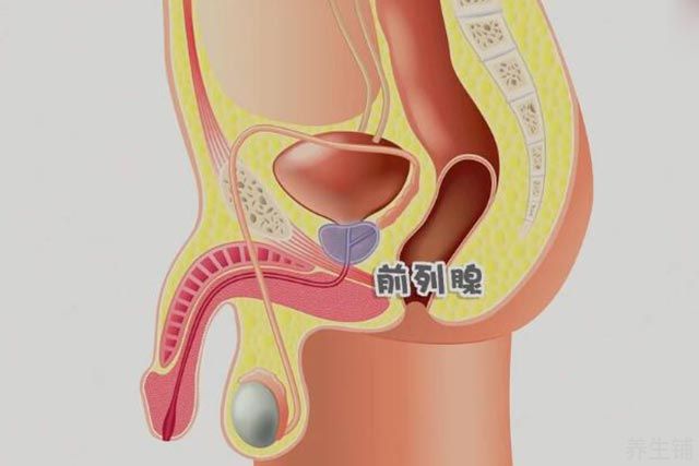 前列腺液检查怎么取液图片